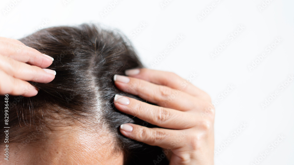 Fototapeta premium woman have hair loss problem