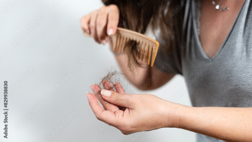 Obraz premium woman have hair loss problem