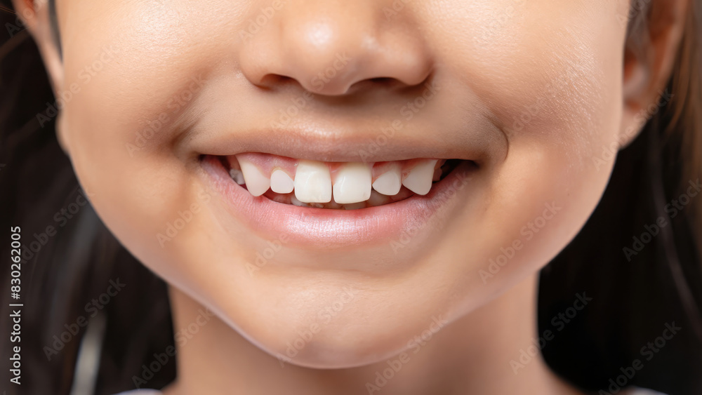 Obraz premium close up on perfect teeth opf a child, kid with perfect dental care, lips of a baby