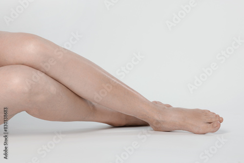 Closeup view of woman with varicose veins on light background © New Africa