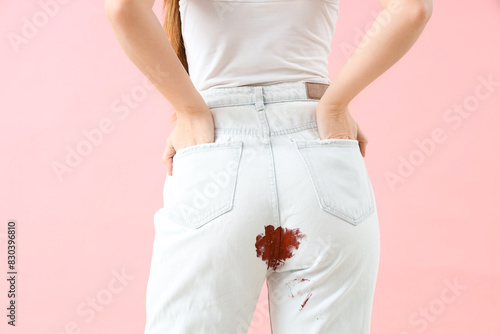 Menstruating woman in stain...