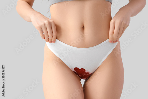 Menstruating woman in stain...