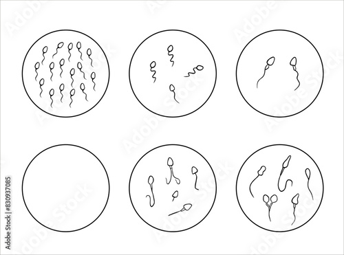 Vector isolated illustration of sperm pathologies. Spermogram. Sperm defects. Defects of the sperm head. Sperm motility.