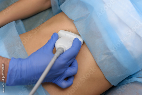 A doctor using an ultrasound transducer performs an ultrasound examination. Ultrasound scanner on a woman’s stomach, ultrasound of internal organs and abdominal cavity. Elastography and sonography.