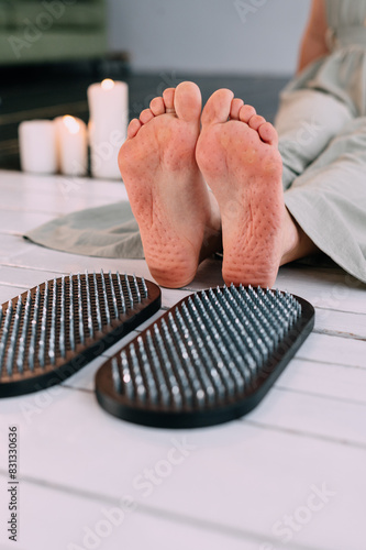 Practice of standing on nails. Nail marks on the feet. A woman sits on the floor after standing on the sadhu's boards. Close-up of feet.