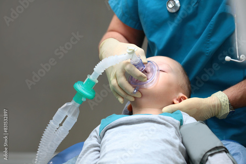 The little boy is under general anesthesia. A breathing tube in the baby's mouth. Surgical intervention. Dental treatment under general anesthesia. Photo in the operating room.