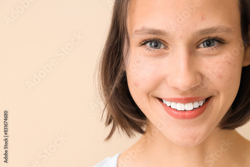 Beautiful young happy woman with acne problem on beige background