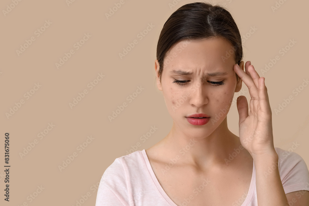Beautiful young worried woman with acne problem on beige background Beautiful young worried woman with acne problem on beige background
