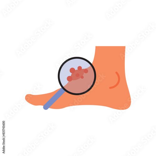 Leg edema, diabetes and foot, leg swelling vector icon, vector graphics