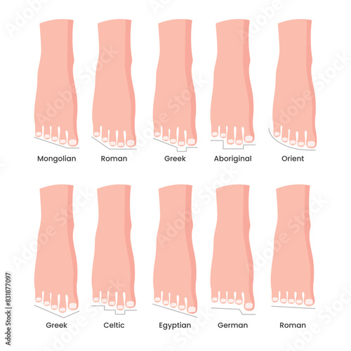 Set of Foot type vector detailed concept with mongolian, germanic, celtic, greek, Egyptian, Orient, Aboriginal, and roman form, types of human forefoot shapes, variations of relative length of the toe