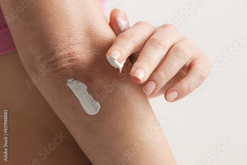 Canvas Print Woman applying elbow cream