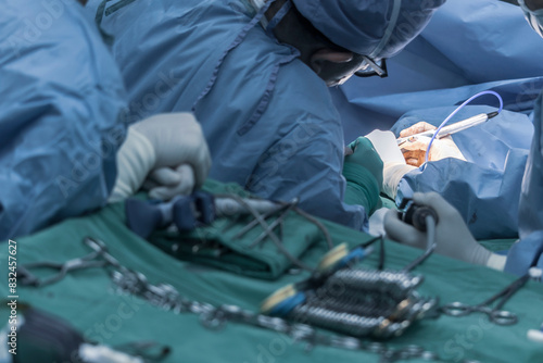 Close-up of a doctor performing heart surgery on a patient in the operating room. Portrait doctor of surgeons in Surgery operating room.