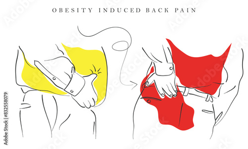 Hand drawn line art vector of Obesity induced Lower back pain