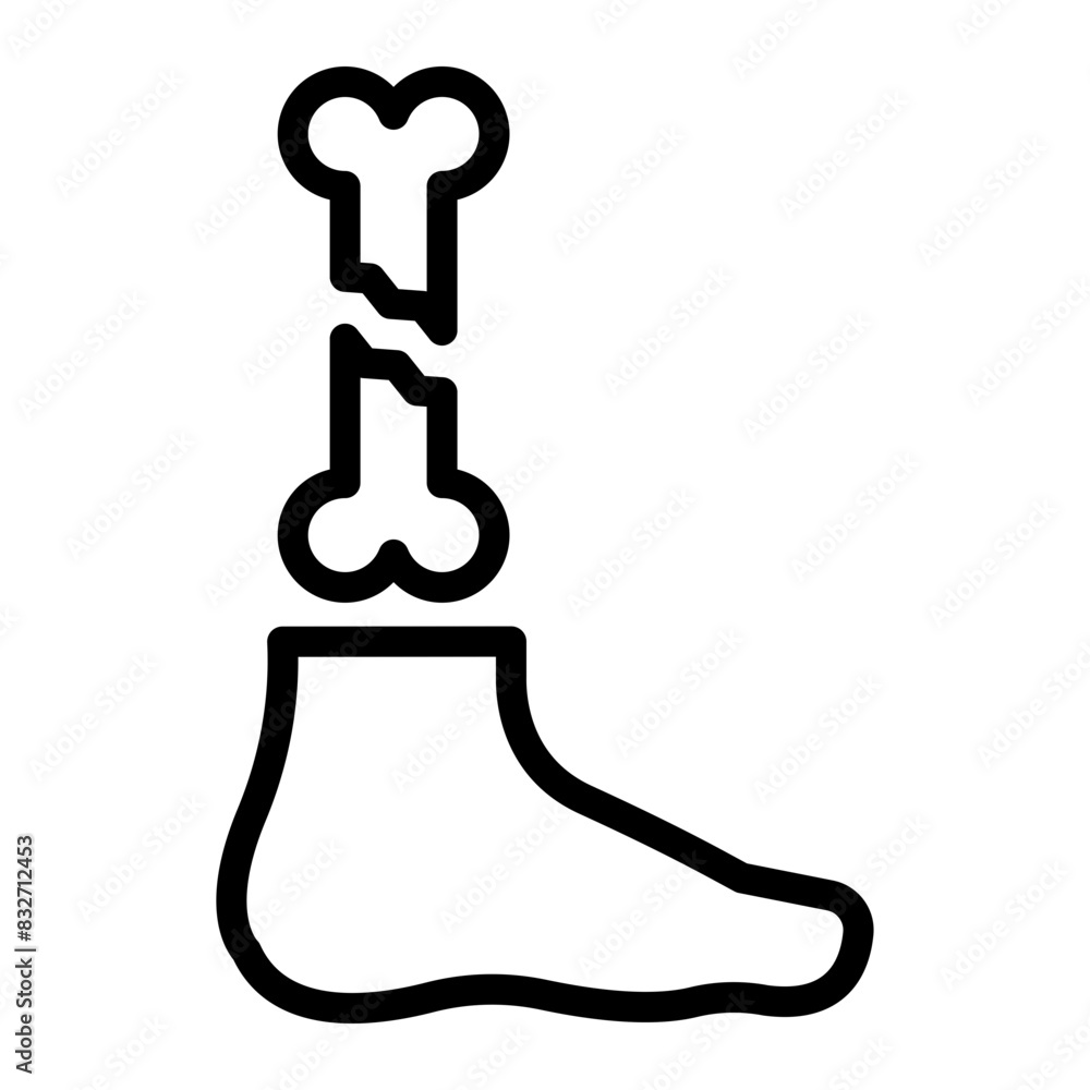 Broken Leg Vector Filled Icon Design Broken Leg Vector Filled Icon Design