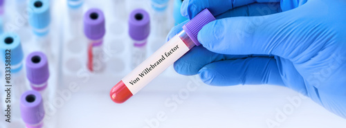 Schilderij op canvas Doctor holding a test blood sample tube with Von Willebrand Factor Test on the background of medical test tubes with analyzes