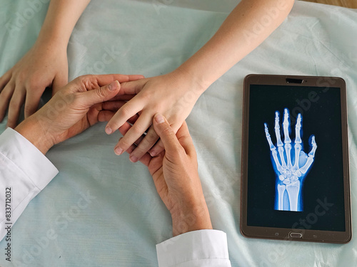 Canvas Print Doctors point to x-ray medical imaging with hand bone disease