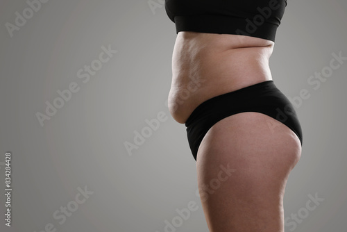 Woman with excessive belly fat on grey background, closeup. Overweight problem photo