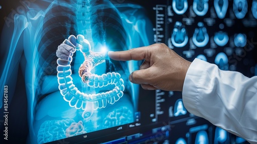 A doctor pointing at a detailed X-ray of a colon displayed on a computer screen in a modern medical facility. colon cancer in x-ray digital screen photo