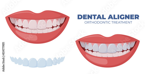 Orthodontic1-06.eps