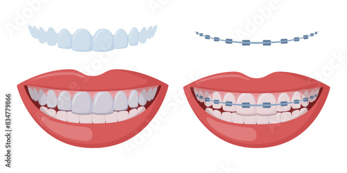 Orthodontic1-14.eps