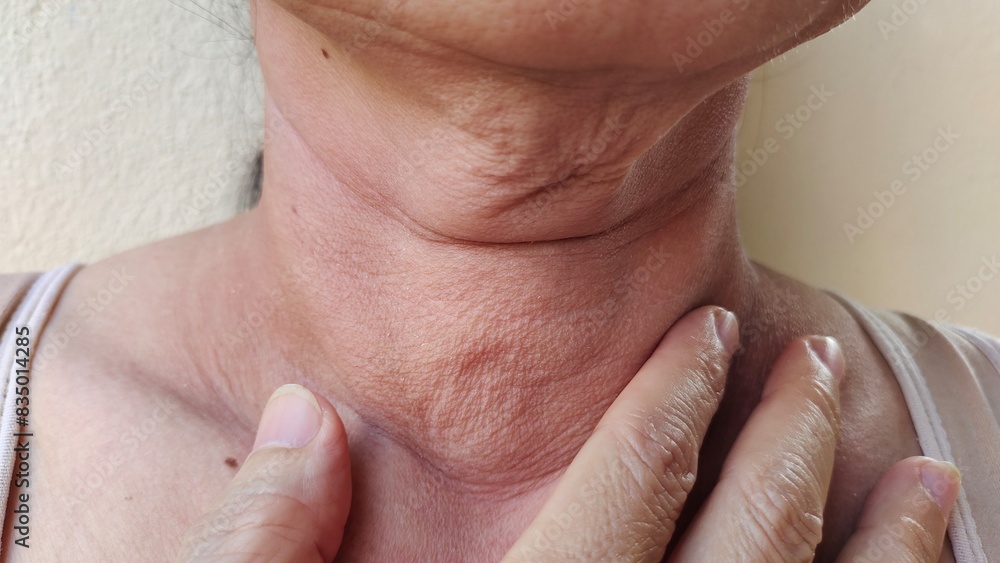 Fototapeta premium Portrait the wrinkle and Flabby skin under the chin, neck wattle and loose, Flabbiness and cellulitis on the body of middle aged 55 year old, health care and beauty concept.