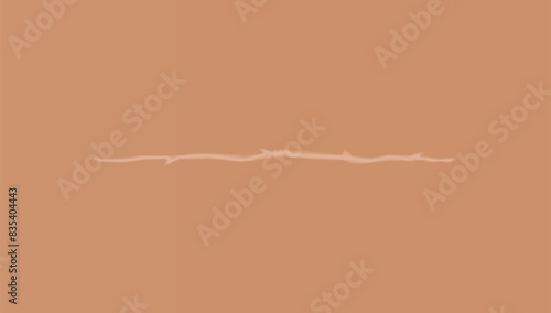 Healing wounds, skin scar, stitched gash and cut. Realistic surgical suture, stitched wounds. Healing stage on human skin background. Vector illustration