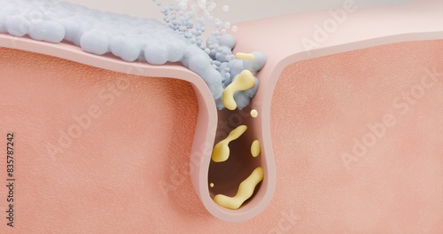 Fotografía 3D illustration of the process of using cleansing foam and acne treatment