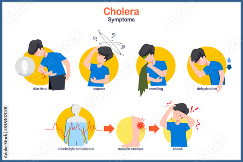 Medical vector illustration in flat style of cholera. Symptoms of cholera,diarrhea,nausea,vomiting, dehydration.electrolytes imbalance.