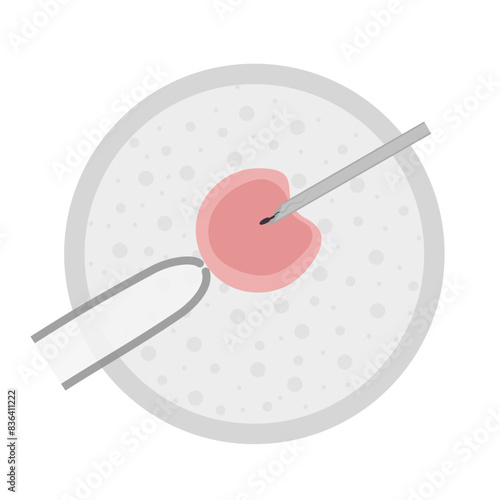 Hand drawn image of in vitro human artificial fertilization in petri dish with tube and needle.