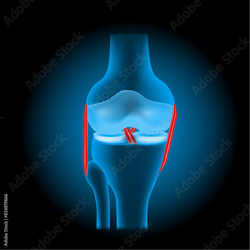 ligament injuries to the knee joint