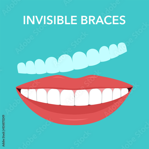Woman wearing orthodontic silicone trainer. Invisible braces aligner. invisalign braces or invisible retainer. beautiful smile.