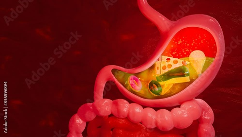 pizza and sweet foods. Junk food. Symptoms of acid reflux or excess acid in the stomach. Gastric juice and intestinal model within the abdominal cavity. Pressure  air causes stomach pain. 3D Rendering photo