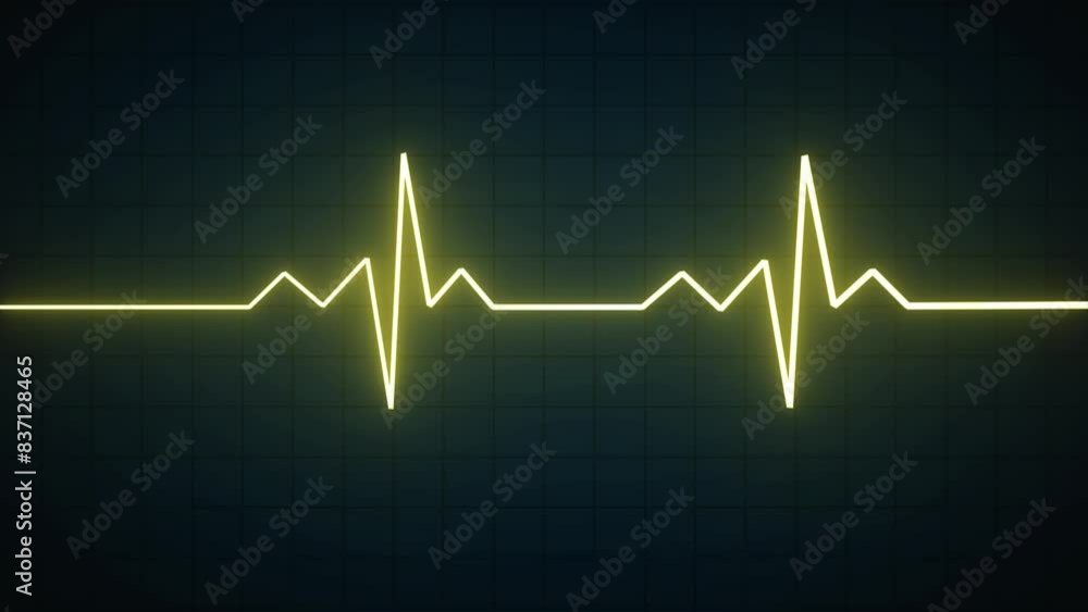 Nubes Globing Neon Heart Pulse Graphic Illustration Cardiogram heartbeat heat pulse glowing yellow color neon light loop animated black background. Nubes Globing Neon Heart Pulse Graphic Illustration Cardiogram heartbeat heat pulse glowing yellow color neon light loop animated black background.