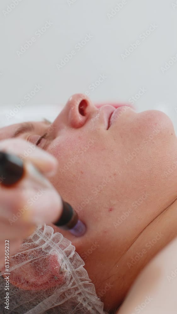 Peeling, woman health care, skin regeneration, dermapen microneedling, dermastamp. Beautician cosmetologist doing cheeks face procedure fractional microneedle mesotherapy clinic facial rejuvenation Peeling, woman health care, skin regeneration, dermapen microneedling, dermastamp. Beautician cosmetologist doing cheeks face procedure fractional microneedle mesotherapy clinic facial rejuvenation