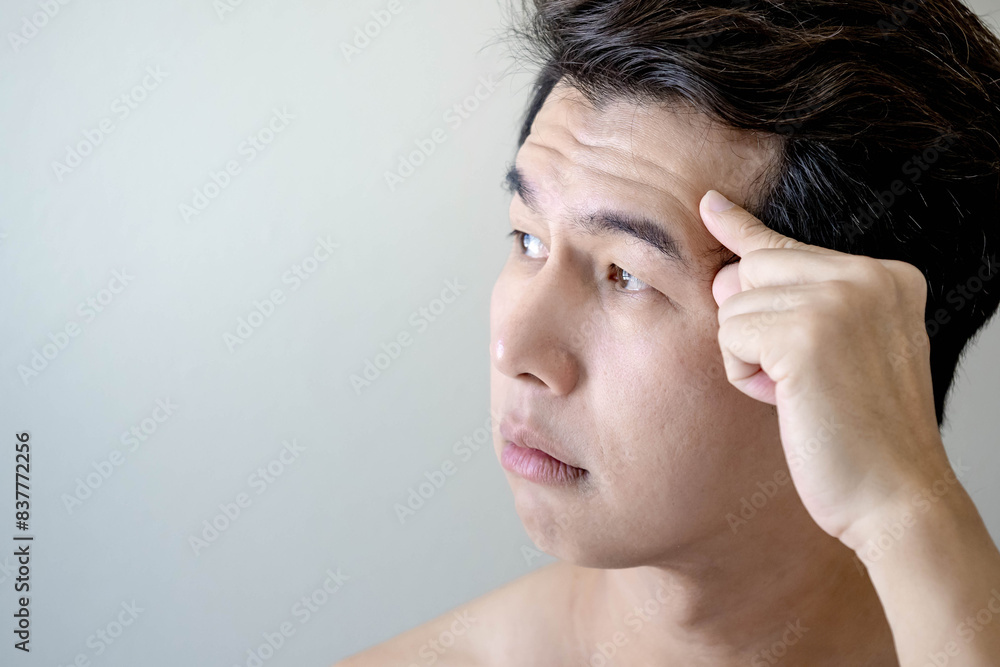 Portrait of Asian man looking away pointing at forehead crease wrinkle on face. Facial complexion treatment and rejuvenation by skincare and cosmetic cream. Mens beauty cosmetology. Anti aging concept Portrait of Asian man looking away pointing at forehead crease wrinkle on face. Facial complexion treatment and rejuvenation by skincare and cosmetic cream. Mens beauty cosmetology. Anti aging concept