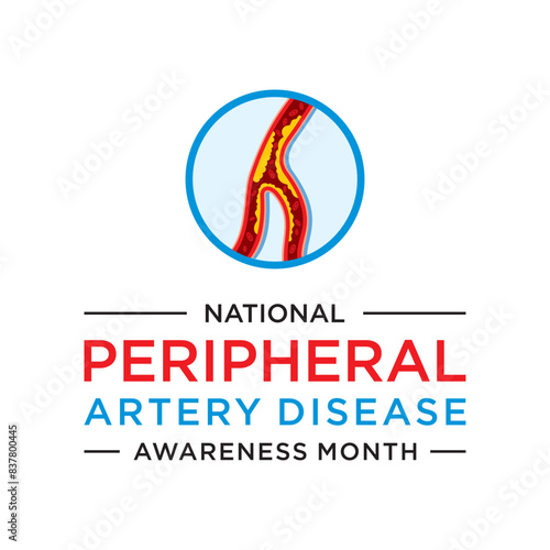 Peripheral Artery Disease (PAD) Awareness Month is an annual observance dedicated to raising awareness about peripheral artery disease.