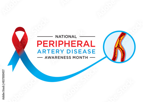 Peripheral Artery Disease (PAD) Awareness Month is an annual observance dedicated to raising awareness about peripheral artery disease,.