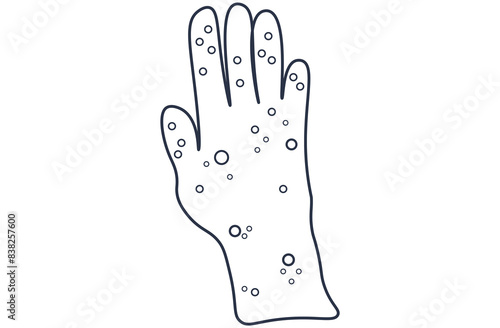 Autoimmune progesterone dermatitis,urticaria,Bullous pemphigoid,herpetiformis,Dermatomyositis,Epidermolysis bullosa acquisita,Gestational,Hidradenitis suppurativa,Lichen planus,Linear IgA,lineart