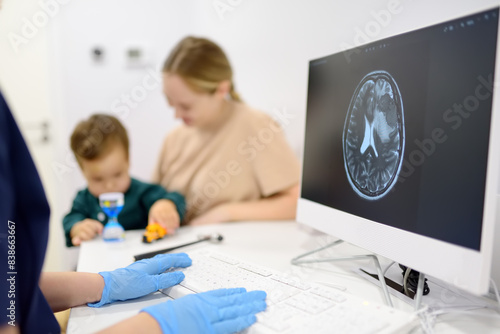 Toddler boy with his mom are at appointment with a pediatric neurologist. A doctor exploring of baby x-ray scan image brain on computer monitor. photo