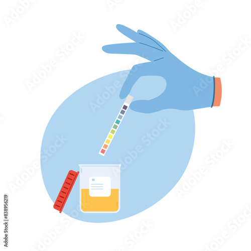 Urine analysis with a pH test. Hand in blue gloves holds an indicator strip for laboratory analysis. Pee sample in plastic container