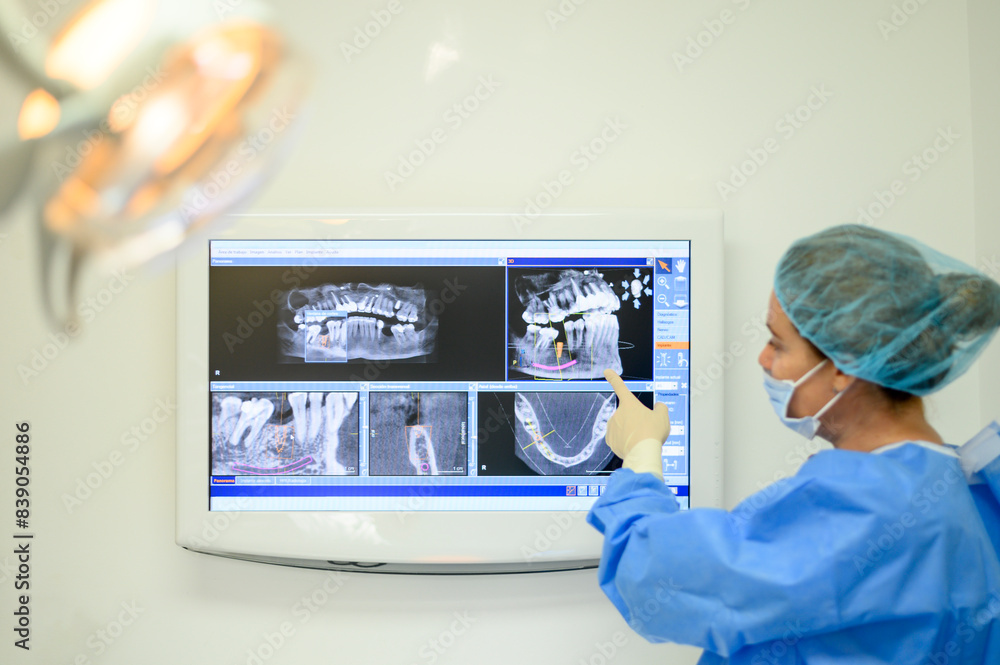 Dentist surgeon showing implant radiography