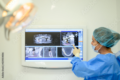 Obraz na płótnie Dentist surgeon showing implant radiography w salonie