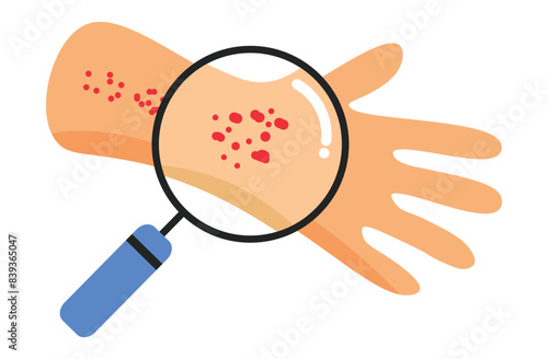 Autoimmune progesterone dermatitis,urticaria,Bullous pemphigoid,herpetiformis,Dermatomyositis,Epidermolysis bullosa acquisita,Gestational,Hidradenitis suppurativa,Lichen planus,Linear IgA,pain