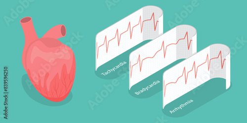 3D Isometric Flat Vector Illustration of Pathological Heart Rhythm Types, Electro-cardiogram
