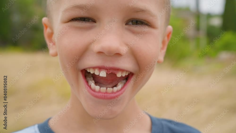 A 5-year-old boy, with a missing front tooth, smiles happily and enjoys life. Pediatric dentistry. close-up A 5-year-old boy, with a missing front tooth, smiles happily and enjoys life. Pediatric dentistry. close-up