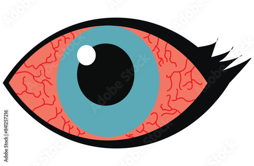 Mucous membrane pemphigoid,Cicatricial,chronic autoimmune causing blistering and scarring of the mucous membranes, including the eyes,Stevens-Johnson syndrom,ocular,Mooren's ulcer,vectors