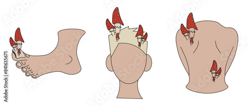 Set of Fungus concept isolated white. Vector illustration of  Micosis Diseases with Toadstoolsl. Flat Fungal Infection art.
