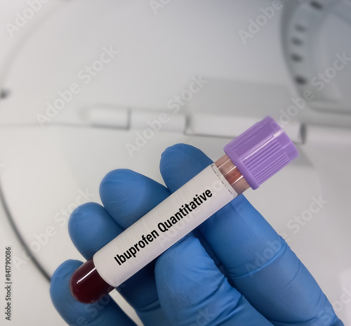 Ibuprofen. Blood sample in a container for analysis of Ibuprofen drugs test. drugs, trace elements and hormones.Optimize drug therapy and monitor patient adherence. photo