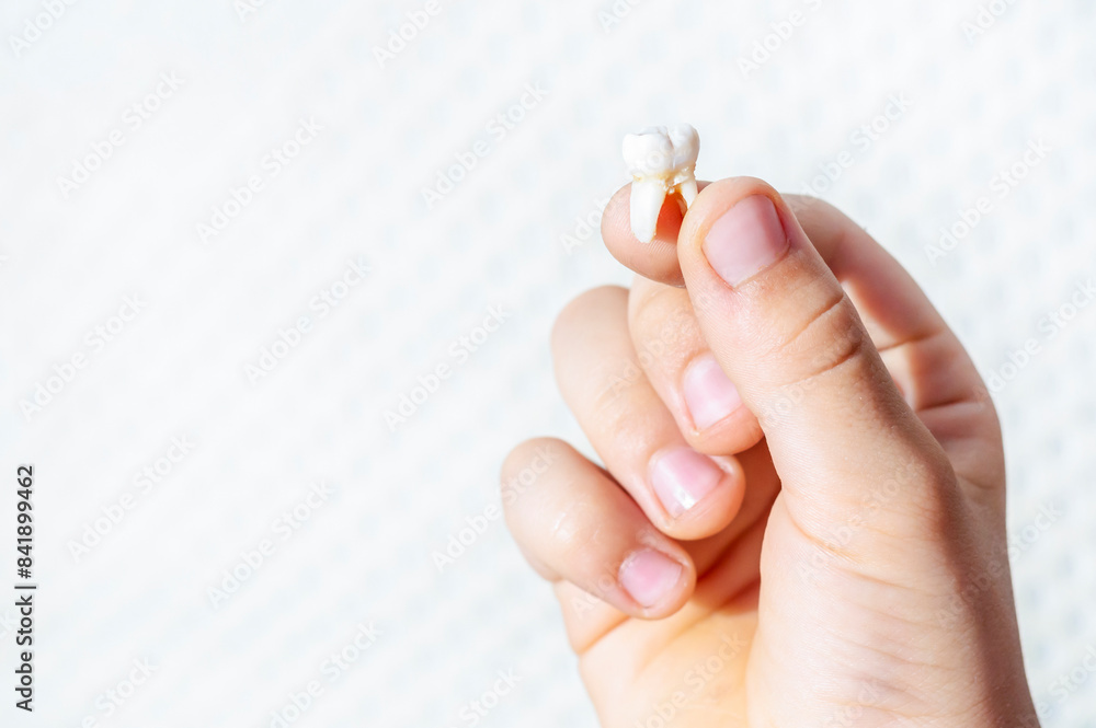 A large milk tooth in a child’s hand close-up. Children's dentistry. Changing children's teeth. Dentistry and health concept. A large milk tooth in a child’s hand close-up. Children's dentistry. Changing children's teeth. Dentistry and health concept.