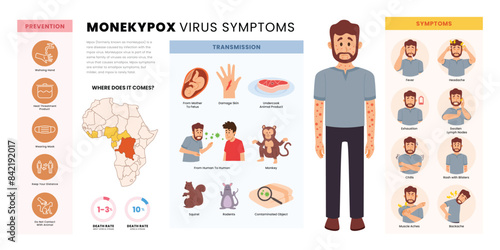 Monkeypox virus infographic medical poster design, labeled Infection, transmission, symptoms, prevention of the disease of monkey pox, cause skin infections, vector illustration, flat vector.